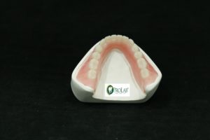 full dentures 2